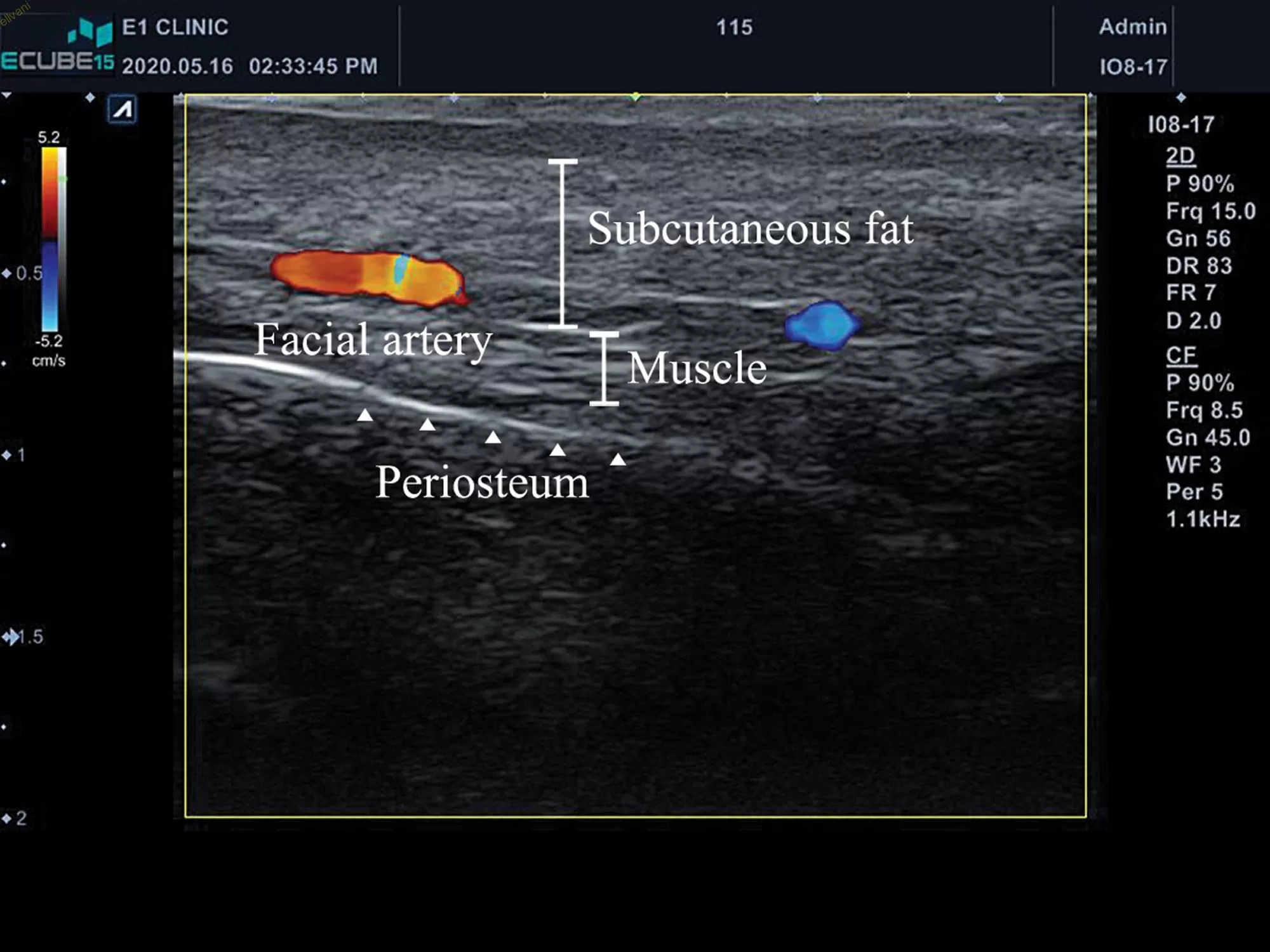 Original.01720096-202206000-00014.F1 - 副本.webp